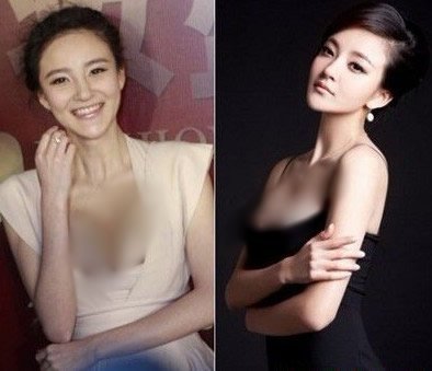 女明星谁隆过胸 哪些明星隆胸了