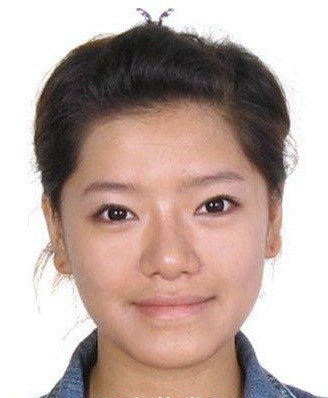 江映蓉整容前后照片