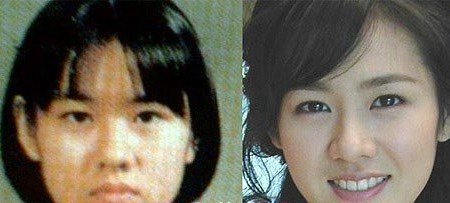 韩国明星金善雅整容图片