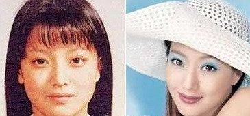 金喜善整容前后对比图片