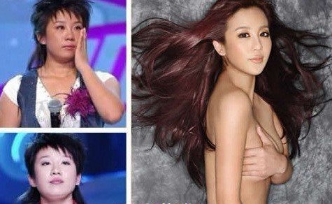 张冬玲整容前后对照图片