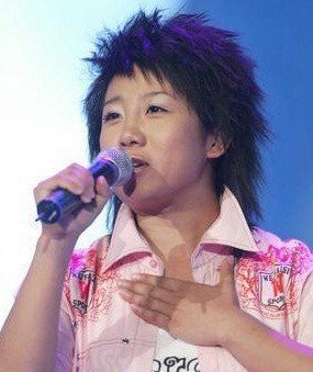 张冬玲整容前后对照图片