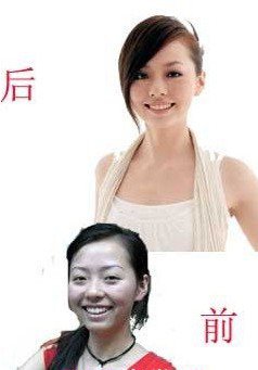 张靓颖整容前照片