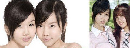 新加坡by2整容前后照片
