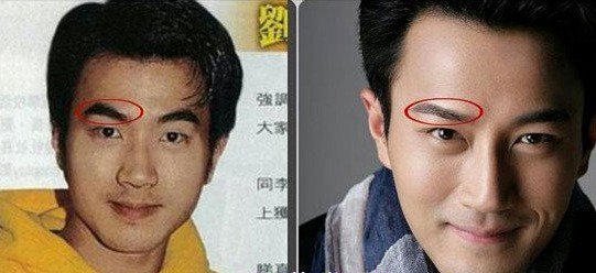 刘恺威整容前后照片对比