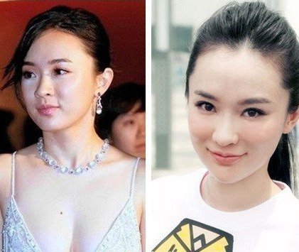 霍思燕整容前后照片