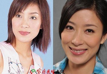 杨怡整容了吗 杨怡个人资料