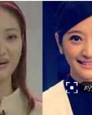 лӱӱ�������Ϻ�ͼƬ лӱӱ����ǰ��Ա���