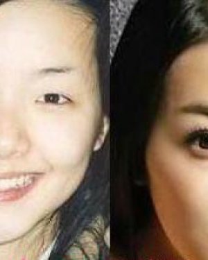 ����������������� ����������ǰ��Ա�ͼƬ