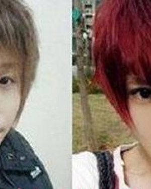 ��ѫ�������� ��ѫ����ǰ��Ա�ͼƬ